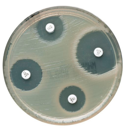 Thermo Scientific™ Oxoid™ Antimicrobial Susceptibility Testing Discs